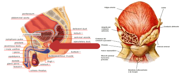 acute prostatitis discharge fájdalom amikor a prosztata vizelete van